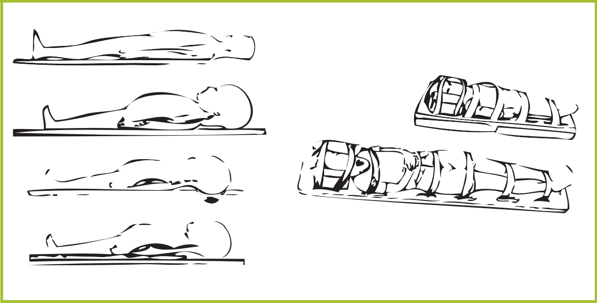 Figure 1. Scene Immobilization