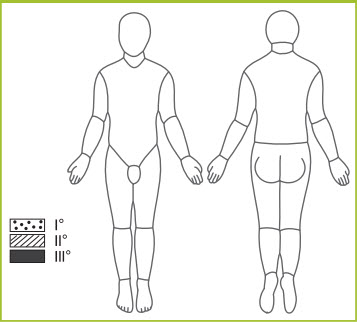 FIGURE 13. Lund-Browder Chart